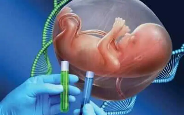شایع‌ترین بیماری‌های ژنتیکی قبل از تولد، با انجام «غربالگری» قابل کنترل هستند